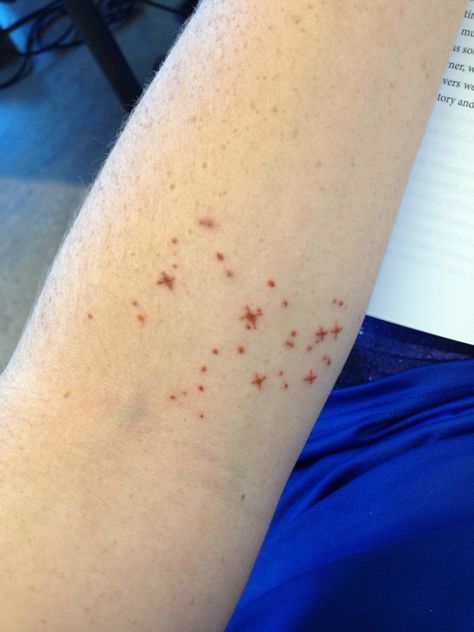 Brown ink. Pleiades star cluster. Constellation tattoo. Inside the elbow tattoo. The Elbow Tattoo, Pleiades Star Cluster, Brown Tattoo Ink, Browning Tattoo, Elbow Tattoo, Constellation Tattoo, Elbow Tattoos, Star Cluster, Constellation Tattoos