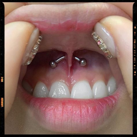 Smiley Piercing - Piercing Idea Cheeks Piercing, Smile Piercing, Piercing Inspo, Gummy Smile, Smiley Piercing, Jewelry Piercing, Airbrush App, Piercings Unique, Body Jewelry Piercing