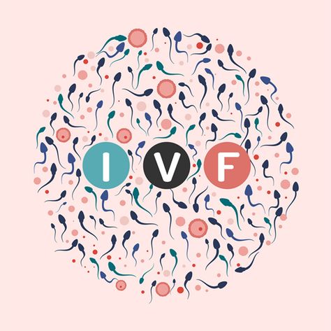 How is IVF Done—Step by Step? - ARC Fertility Embryo Implantation, Ivf Failure, Ivf Success Rates, Ivf Procedure, Ivf Cost, Egg Quality, Assisted Reproductive Technology, Fertility Problems, Ivf Cycle