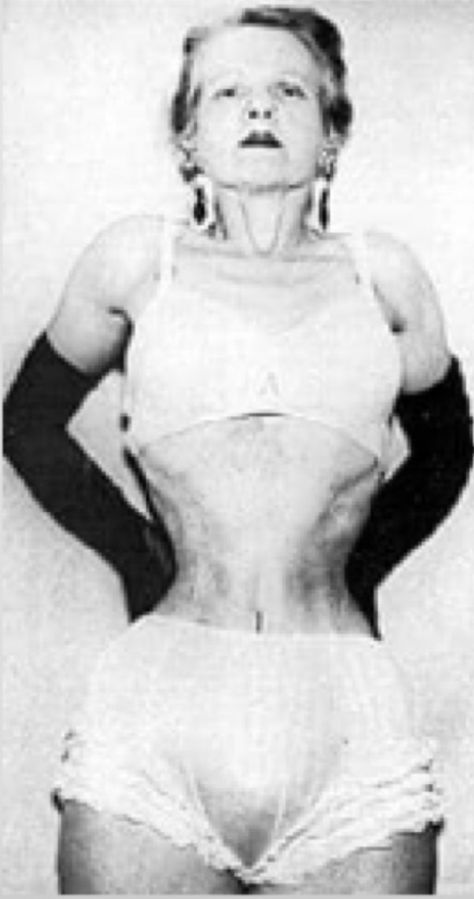 Ethel Granger, Trapped Gas, Human Oddities, Women Skeleton, Corset Training, Lace Tights, Waist Training Corset, After Pictures, Detox Your Body