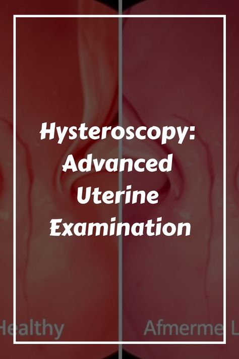 Hysteroscopy: Advanced Uterine Examination on a red background with curved designs. Online Consultation, The Philippines, Random Stuff, Philippines