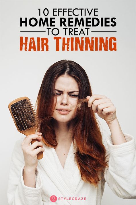 10 Effective Home Remedies To Treat Hair Thinning Tips For Thinning Hair, Treat Thinning Hair, Thinning Hair Remedies, Thick Hair Remedies, Hair Thinning, Homemade Hair Products, Healthy Hair Tips, Diy Hair Care, Hair Control