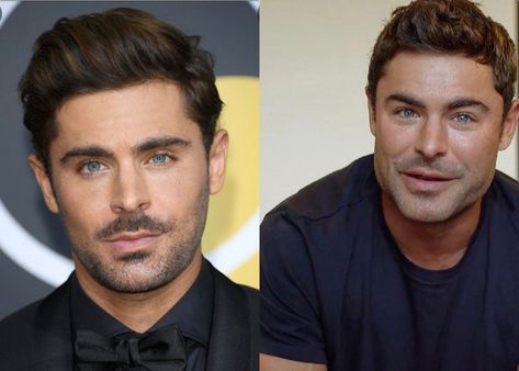 Famous Men Actors, Dylan Efron, Plastic Surgery Transformation, Zac Efron 2023, Zac Efron Beard, Zac Efron Plastic Surgery, Zac Efron Muscle, Zac Efron Before And After Surgery, Zac Efron Hair