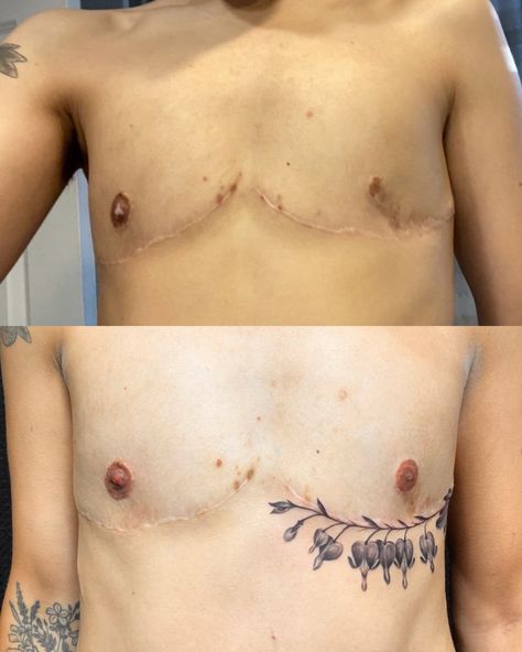 Top Surgery Tattoo Flower, Trans Masc Chest Tattoos, Top Surgery Chest Tattoo, Chest Surgery Tattoo, Tattoos Top Surgery, Top Surgery Scar Coverup Tattoo, Post Top Surgery Tattoos, Ftm Top Surgery Scar Tattoo, Too Surgery Tattoo