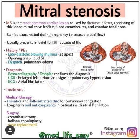 Mitral Stenosis, Cardiac Sonography, Human Heart Anatomy, Mitral Valve, Family Nurse Practitioner, Cardiac Nursing, Heart Anatomy, Medical Studies, Nursing Study