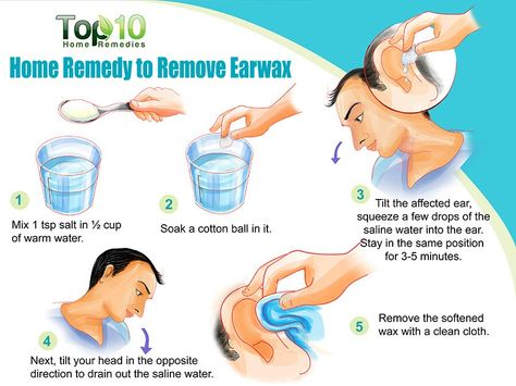 Home Remedy to Remove Earwax Ear Wax Buildup, Saline Water, Dry Skin Routine, Top 10 Home Remedies, Morning Workouts, Cleaning Your Ears, Ear Wax Removal, Cotton Swabs, Ear Cleaning