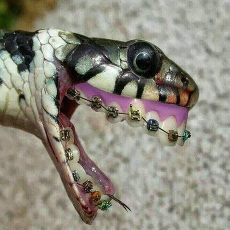 Braces Funny, Funny Snake, Funny Picture, Braces, Do Anything, Funny Animals, Funny, On Instagram