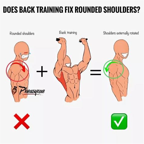 Scapular Winging, Rounded Shoulder Exercises, Anatomy Neck, Scapula Exercises, Fix Rounded Shoulders, Dowager's Hump, Anterior Pelvic Tilt, Tokyo Ghoul Pictures, Shoulder Posture