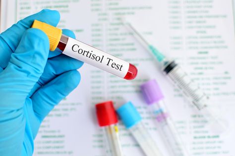 Thyroid Test Results, Low Ferritin, Thyroid Levels, Thyroid Test, Cholesterol Test, Pathology Lab, Thyroid Medication, Vitamin D Supplement, Thyroid Function