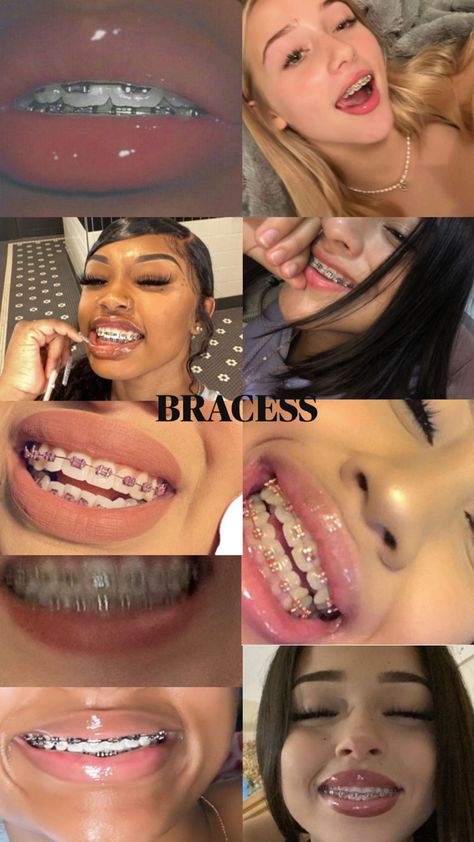 Cute Braces Colors, Teeth Aesthetic, Pretty Teeth, Braces Tips, Getting Braces, Braces Girls, Cute Braces, Healthy Hair Routine, Diamond Teeth