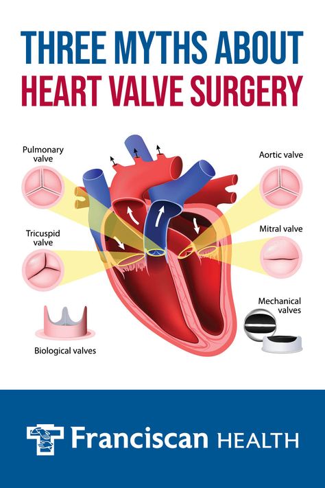 Aortic Valve Replacement, Heart Valve, Tricuspid Valve, Cardiac Disease, Mitral Valve, Heart Valves, Open Heart Surgery, About Heart, Medical Studies