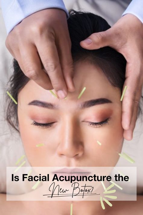 Embrace Youthful Glow! 💫 From fillers to Botox, and now, holistic trends like facial acupuncture. 🌺 Revive your radiance naturally with increased blood flow, plumper skin, and fewer lines. Meet Gudrun Snyder, founder of @moonrabbitacupuncture, sharing all about facial acupuncture's magic. {Click the link!} ✨🌼 Facial Acupuncture, Chinese Healing, Japanese Medicine, Benefits Of Cupping, Holistic Therapy, Muscles Of The Face, Cupping Therapy, Holistic Therapies, Eating Tips