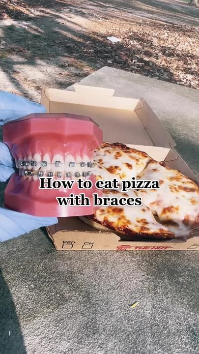 TikTok · hestermorris_ortho Food Braces Ideas, Food To Eat With Braces, Foods To Eat With Braces, Braces Ideas, Braces Before And After, Braces Food, Food To Eat, Eat Pizza, Foods To Avoid