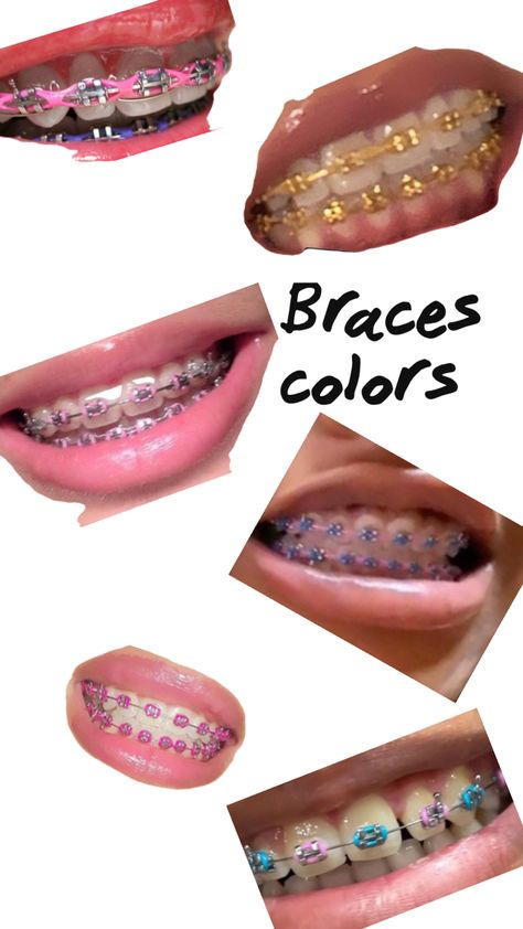 Color Braces Ideas, Braces Colors Combinations, Braces Ideas, Pink Braces, Pretty Eyes Color, Cute Braces Colors, Pretty Teeth, Braces Tips, Getting Braces