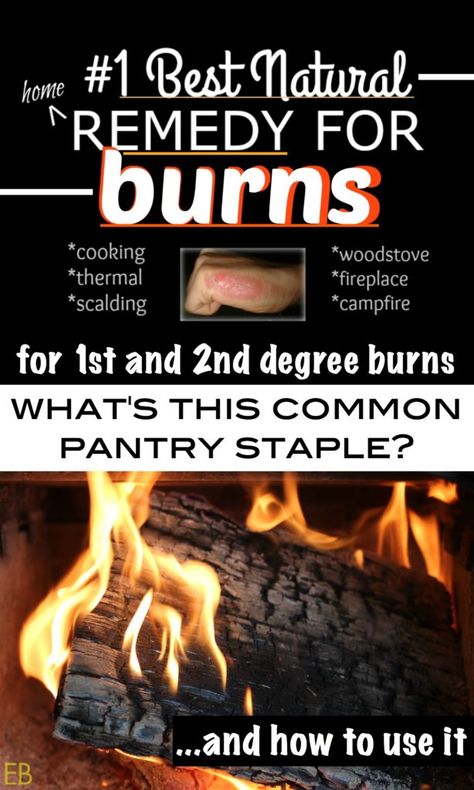 #1 Best Natural Home Remedy for Burns Home Remedies For Burns, 2nd Degree Burns, Burn Remedy, Burn Relief, Diy Natural Remedies, Eat Beautiful, Medicine Chest, Holistic Health Remedies, Health Blogger