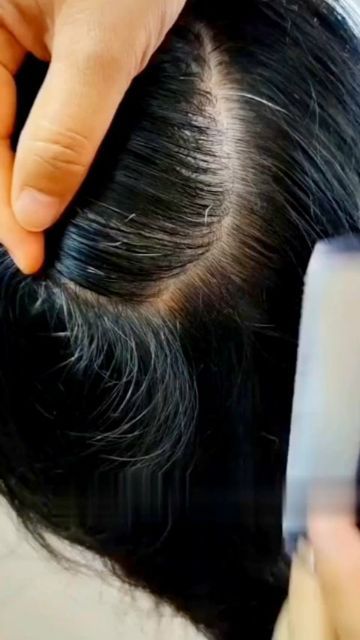 White Hair Solution, Hair Solution, Instagram White, Hair Solutions, Hair Colour, White Hair, Health And Beauty, Hair Color, At Home