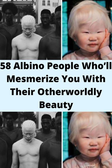 Albino People, Makeup Fails, Spotlight Stories, Wife Jokes, Celebrity Halloween Costumes, Prom Photos, Celebrity Trends, Photo Series, Random Acts Of Kindness