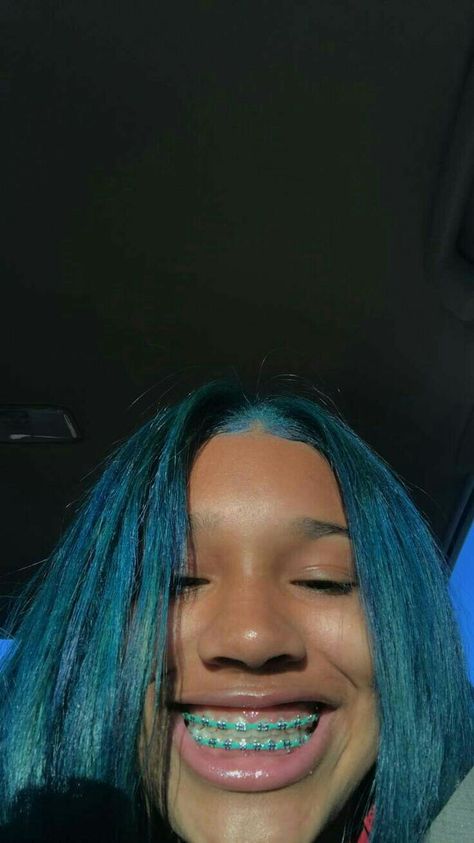 Braces Selfie, Braces Colors, Braces, Blue Hair, Skin, The World, Hair, Blue