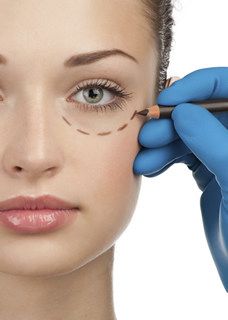 Blephoraplasty Surgery, Saggy Eyes, Bad Plastic Surgeries, Under Eye Fillers, Tear Trough, Eyelid Lift, Facial Fillers, Facial Plastic Surgery, Facial Aesthetics