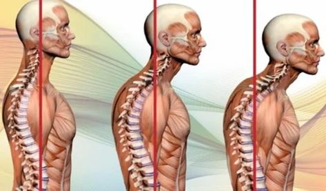 Uncomfortable Neck, Shoulders, Or Back? Neck Hump, Health Care Aide, Healthy Chinese, Neck Bones, Neck Exercises, Stiff Neck, Healthy Goals, Neck Pain Relief, When You Sleep