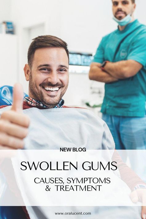 Swollen gums can be the cause of numerous oral health concerns. Check out our blog to find out if it may be causing yours! #OralHealth Swollen Gums Remedy, Gum Inflammation, Swollen Gum, Oral Care Routine, Receding Gums, Gum Care, Oral Health Care, Tooth Decay, Oral Hygiene