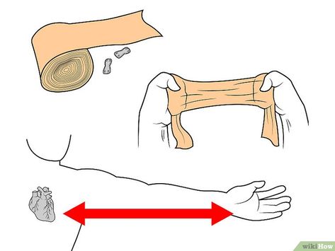 How to Wrap a Wrist - wikiHow Sprained Wrist, Wrist Injury, Wrist Pain, How To Wrap, Pre Wrap, Carpal Tunnel, Wrist Wrap, Fall Prevention, School Of Medicine