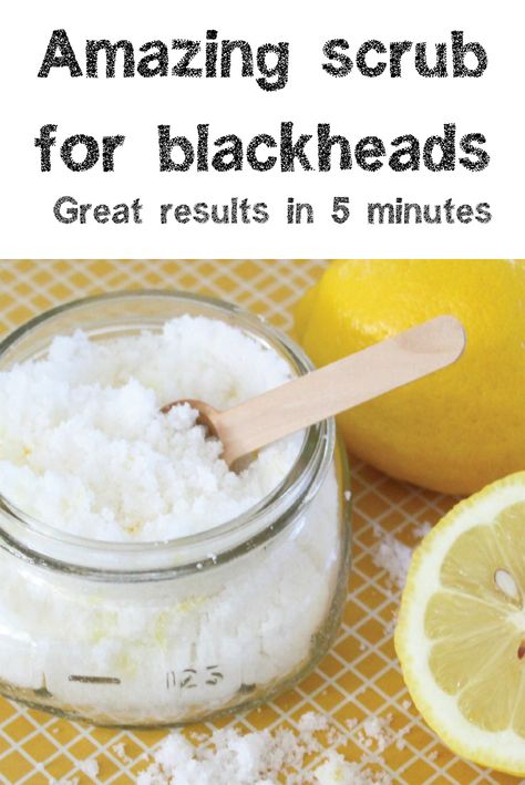 SCRUB FOR BLACKHEADS - RESULTS IN 5 MINUTES Face Scrub For Blackheads, Homemade Sugar Wax, Diy Facial Scrub, Homemade Face Scrub, Blackhead Scrub, Diy Face Wash, Blackhead Remover Diy, Diy Face Scrub, Scrub Homemade