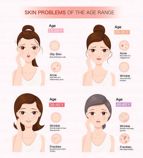 Skin problems of the age range Premium V... | Premium Vector #Freepik #vector #woman #cartoon #pink #beauty Sun Spots Removal, Skin Therapist, Natural Acne Remedies, Skin Diseases, Skin Tips, Better Skin, Skin Tightening, Skin Care Essentials, Skin Rejuvenation