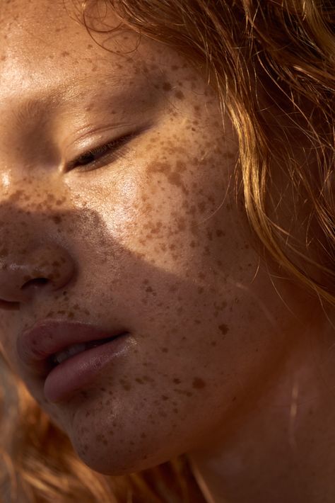 tehya elam Beautiful Freckles, Face Study, Linda Evangelista, Claudia Schiffer, Christy Turlington, Chin Up, Cindy Crawford, Hair Reference, Ginger Snaps