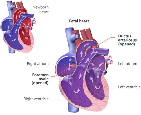 fetal heart circulation - Google Search Patent Ductus Arteriosus, Low Birth Weight Babies, Obstetrics Nursing, Heart Circulation, Preterm Baby, Heart Diagram, Cat Crying, Heart Defect, Weight Baby