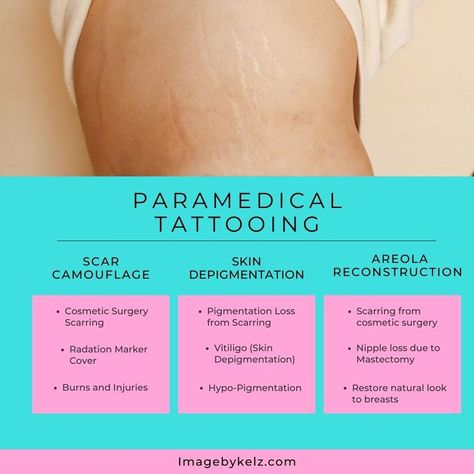 Paramedical Tattoo Studio, Paramedical Tattooing, Paramedical Tattoo, Tattoo Now, Salon Ideas, Pop Ups, Cosmetic Surgery, Permanent Makeup, Nursing School