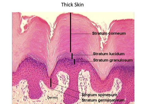 Thick Skin - Epidermal Layers - Histology Skin Under Microscope, Skin Histology, Getting Rid Of Scars, Under Microscope, Skin Anatomy, College Of Medicine, Acne Scarring, Scar Cream, Thick Skin