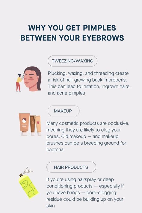 It’s easy to spot a breakout, but it’s harder to identify exactly why that certain area is acting up. We sat down with our founder, board-certified dermatologist Dr. Sandra Lee (aka Dr. Pimple Popper), to clear things up and find out why pimples pop up between our eyebrows. Avoid Pimples Tips, Clear Things, Tweezing Eyebrows, Sandra Lee, Old Makeup, Deep Conditioning, Ingrown Hair, Grow Hair, Makeup Brushes