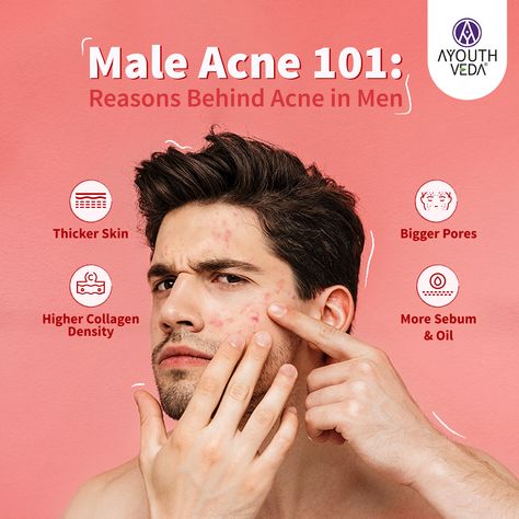 Did you know male skin is extremely prone to acne? Acne knows no gender. Men's skin is acne-prone due to higher testosterone levels and oil production. 🧏‍♂️ Hormonal fluctuations, stress, and environmental factors can all contribute to acne in men. Discover the natural way to achieve healthier skin with Ayouthveda! ☘️ Acne Advertising, Attractive Guys With Acne, Men Acne Skin Care, Acne Awareness Month Quotes, Male Acne, Acne Qoutes, Acne Men, Big Pores, Bad Acne