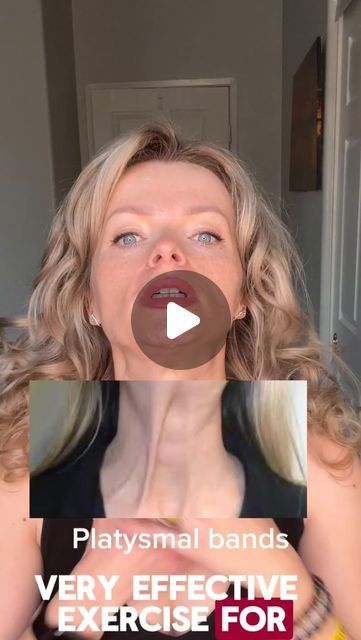 Platysma Muscle Exercise, Neck Massage Techniques, Platysmal Bands, Face Massage Techniques, Muscles Of The Face, Neck Muscles, Natural Face Lift, Band Exercises, Face Exercises