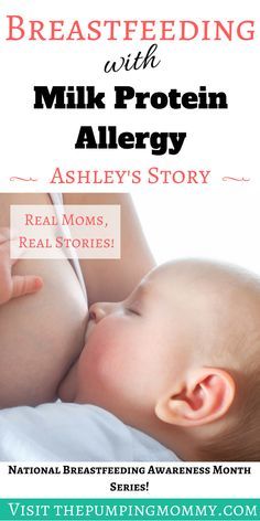 Cow's Milk Protein A Cows Milk Protein Allergy, Breastfeeding Awareness Month, How To Breastfeed Newborns, Protein Milk, Cow's Milk, Pumping At Work, Breastfeeding Positions, Breastfed Baby, Real Moms