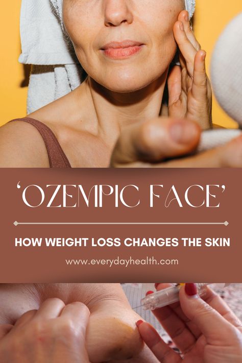 Ozempic Face, Counting On, Healthy Beauty, Lose 50 Pounds, Skin Texture, Skin Tightening, Weight Management, The Skin, Healthy Tips