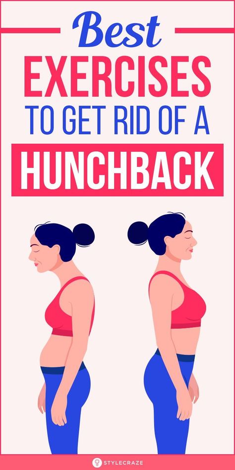 Fix Back Posture, Neck Hump Correction, Buffalo Hump Exercises, Massage Ball Exercises, Hunchback Posture, Dowager Hump, Hunched Back, Hunch Back, Female Posture