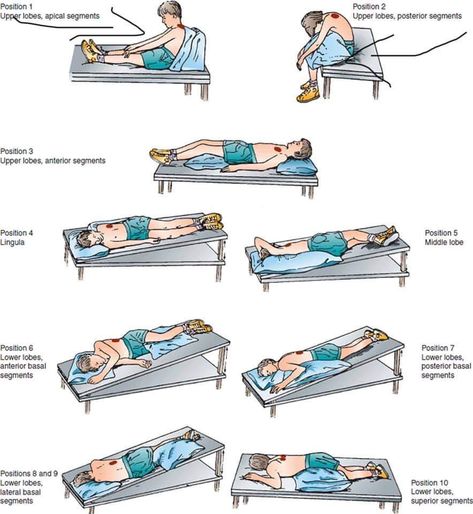 Chest Physiotherapy, Postural Drainage, Rehab Nursing, Posture Stretches, Lung Anatomy, Physical Therapy Assistant, Nursing Assessment, Belly Breathing, Marching Band Humor