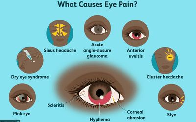 Corneal Abrasion, Eye Medicine, Computer Vision Syndrome, Eye Pain, Blurry Vision, Sore Eyes, Light Sensitivity, Vision Problems, Eyes Problems