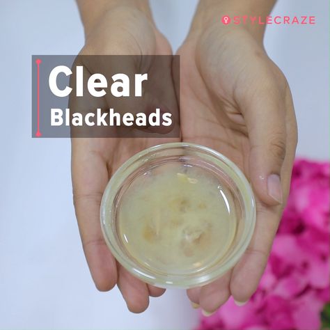 If your skin is anything like the rest of us, which harbors visible pores filled with dirt, or in other words, blackheads, all I can say is that there is still hope. This article lists the best home remedies that will show you how to get rid of blackheads from nose at home. #Remedies #HomeRemedies #BeautyTips #Blackheads Remove Blackheads From Nose, Clear Blackheads, Blackheads On Nose, Rid Of Blackheads, Black Heads, Chemical Products, Diy Remedies, Get Rid Of Blackheads, Natural Diy