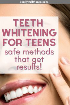 How Whiten Your Teeth, Small Teeth Smile, How To Get Whiter Teeth, How To Get White Teeth, How To Whiten Teeth, Teeth After Braces, Diy Teeth Whitening, Whiten Teeth At Home, At Home Teeth Whitening