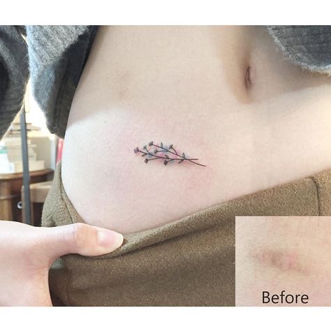 Hide Scar Tattoo, Minimalist Tattoo With Color, Tattoo Over Small Scar, Small Tattoo To Cover Scar, Vertical Scar Tattoo Cover Up, Simple Scar Cover Up Tattoo, Small Scar Cover Up Tattoo, Tattoo Ideas For Scar Cover Up, Tattoo Ideas Scar Coverups