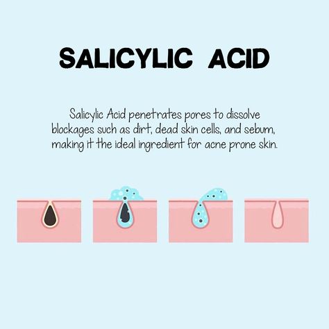 Salicylic Acid is perfect for any Esthetician, or for the Esthetician in your life.  You are purchasing an INSTANT DOWNLOAD file. :) **You can use these files to put it on anything you would like.  ONCE PURCHASED: How do ya get them? - After the payment is cleared, you will be taken to the Etsy download page for download. You can also find the files on your Etsy account under "Orders"/Purchases & Reviews". Etsy will immediately notify you automatically when your download is available. To see mor Esthetician Tips, Esthetician Inspiration, Esthetician Quotes, Esthetician School, Beauty Skin Quotes, Esthetician Room Decor, Esthetics Room, Esthetician Marketing, Skin Facts