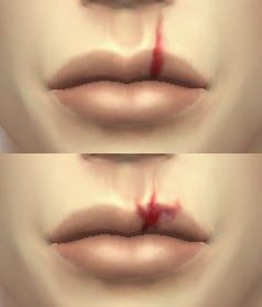 My Sims 4 Blog: Split Lip Scars by DecayClownSims Sims 4 Blog, Sims 4 Cas Mods, The Sims 4 Skin, My Sims, Sims 4 Mm Cc, Sims 4 Body Mods, Sims 4 Cc Skin, Sims 4 Cc Folder, Sims 4 Characters