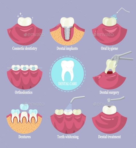 Orthodontics Teeth, Cosmetic Dentistry Procedures, Dental Images, Dental Posters, Dentist Clinic, Dental Art, General Dentistry, Dental Surgery, Clinic Design