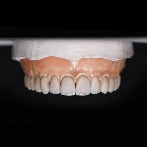 Implant-supported dentures are a game-changer in the realm of restorative dentistry. Unlike traditional dentures, which merely rest on the gums, implant dentures are anchored directly into the jawbone, providing unmatched stability and a natural feel. 

Call us ☎️ 727-513-8283
#NuSmileDental #ImplantSupportedDentures #DentalImplants Implant Dentist, Denture Implants, Columbia City, Oral Surgeon, Tooth Replacement, Implant Dentistry, Restorative Dentistry, Family Dental, Dental Lab