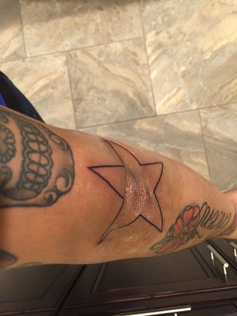 Star Around Elbow Tattoo, Star On Elbow Tattoo, Star On Knee Tattoo, Star Tattoo On Knee, Star Tattoo Elbow, Star Tattoo Knee, Elbows Tattoo, Heart Tattoo Elbow, Knee Star Tattoo