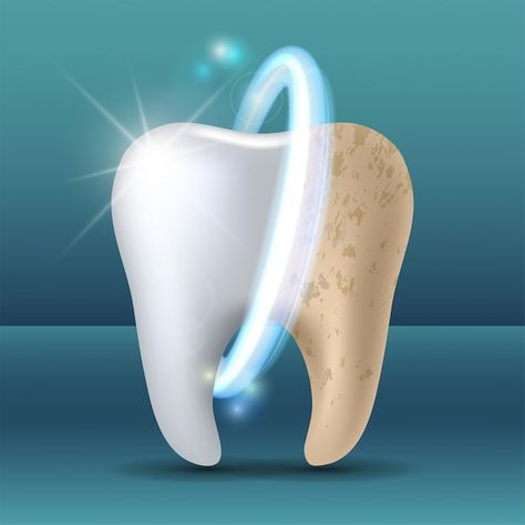 Clean and dirty tooth before and after w... | Premium Vector #Freepik #vector #medical #doctor #health #hospital Dental Advertising, Teeth Whitening Procedure, Dental Images, Dental Posters, Dentist Clinic, Kedokteran Gigi, Discolored Teeth, Dental Hospital, Loose Tooth