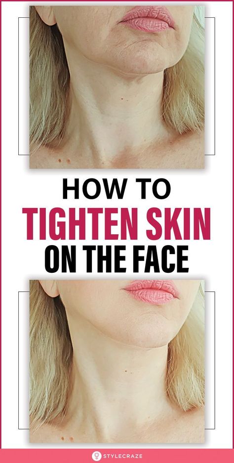 How To Tighten Face Skin Anti Aging, How To Tighten Loose Skin On Face, How To Moisturize Face, How To Tighten Face Skin, Face Tightening Exercises, Skin Problems Face, Tighten Skin On Face, Skin Tightening Face Mask, Tightening Face Mask